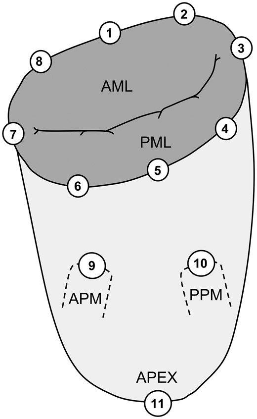 Location of implanted sonomicrometry crystals distributed around the mitral annulus and subvalvular apparatus. The positions of the crystals are defined from the anatomical landmarks: 1: centre of trigones; 2: right trigone; 3: posterior commissure; 4: P3 scallop; 5: centre of the posterior annulus (P2 scallop); 6: P1 scallop; 7: anterior commissure; 8: left trigone; 9: anterior papillary muscle (APM); 10: posterior papillary muscle (PPM); 11: left ventricular apex; AML: anterior mitral leaflet; PML: posterior mitral leaflet.