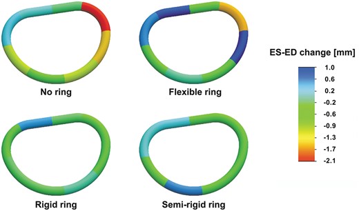 Segmental mitral annular circumferential changes from end-diastole to end-systole for the no ring group and the three annuloplasty ring groups. The annular circumferential changes are illustrated with a scaled colour legend where blue represents a systolic annular circumferential expansion and red represents a systolic annular compression. ES: end-systole; ED: end-diastole.