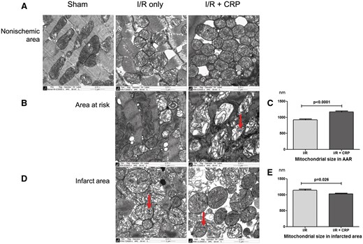 Transmission electron micrographs of non-ischaemic areas, areas at risk and infarct area in myocardium in each group. (A) Non-ischaemic areas in all groups showed normal mitochondria with tightly packed cristae and electron-dense matrices. (B) Mitochondria in areas at risk. In the I/R only group, some mitochondria maintained normal architecture with multiplicity of cristae in their native configuration. In contrast, the CRP infusion group showed that almost all mitochondria had swollen and exhibited disorganization of cristae with abundant autophages formation (arrow) and (C) mitochondrial diameters in AAR were significantly greater after CRP infusion (P < 0.001). (D) Infarct area. Both groups showed amorphous matrix densities that are signs of irreversible ischaemic injury. (E) Mitochondria were more condensed and smaller on AAR in the CRP infusion group (P = 0.026).