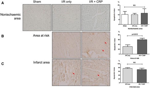 Representative apoptotic cells determined with Terminal deoxynucleotide transferase dUTP Nick End Labelling and quantitative apoptotic indices. Arrows indicate apoptotic cells. Apoptotic nuclei showed brown staining (magnification ×400). (A) In all groups, most myocardial cells in non-ischaemic areas were nonapoptotic. (B) In areas at risk, the CRP infusion group showed increased apoptotic indices (P = 0.013). (C) However, in infarct, there was no significant difference between the 2 groups (P = 0.373).
