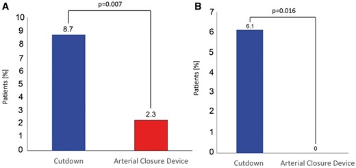 Overall complication rates comparing surgical access to the groin vessel and the use of ACDs for all cases (A) and for the time period of the first 100 ACD cases (B).