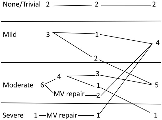 Outcome of mitral regurgitation on follow-up in the 1–12-year age group. MV: mitral valve.