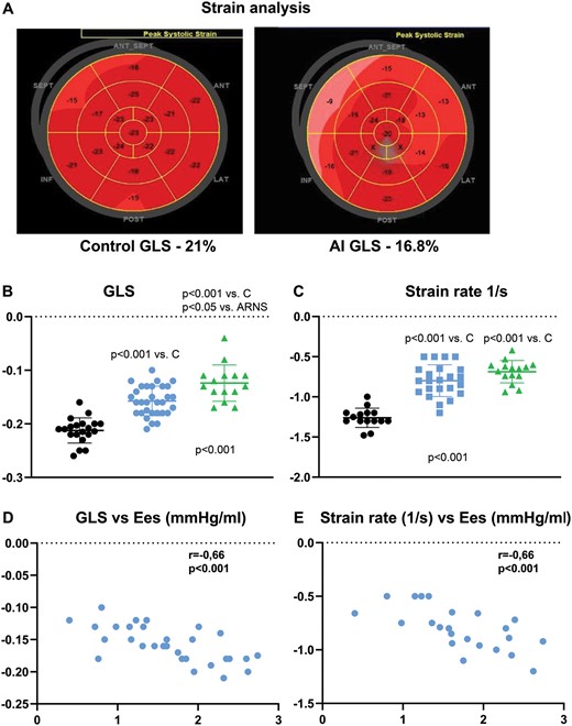 (A) Representative strain bull’s eye of a control (left side) and of an ARNS patient (right side); (B) comparison of GLS and (C) strain rate in controls (black, n = 20), ARNS (blue, n = 31) and ARS (green, n = 15); correlation of GLS (D) and strain rate (E) versus Ees in ARNS patients. For P-values of (B) and (C) see Fig. 2. ARNS: patients with high-grade AR without indication for surgery; ARS: patients with high-grade AR with indication for surgery; Ees: end-systolic elastance; GLS: global longitudinal strain.