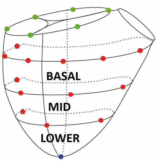 Schematic representation of right ventricular epicardial sonomicrometry crystal array. Green sphere = tricuspid annular crystals, red spheres = right ventricular free wall epicardial crystals and blue sphere = right ventricular apex (A color version of this figure appears in the online version of this article).