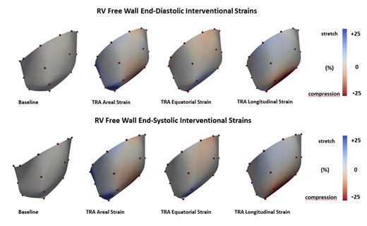 Coloured maps of right ventricular free wall interventional strains. Equatorial, longitudinal and areal epicardial deformation presented at point of end-diastole and end-systole referenced to Baseline. Red colour indicates myocardial compression and blue colour myocardial stretch. Colour tone bars indicate range of deformation (A color version of this figure appears in the online version of this article).
