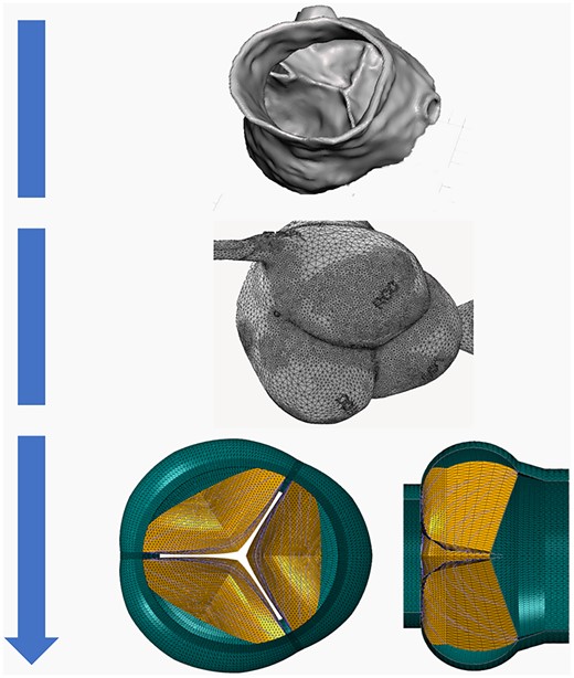 Schematic representation of finite elements model creation of the aortic root and valve, starting from computed tomography reconstruction through geometric mesh.