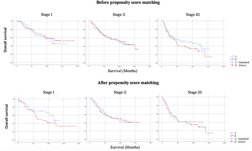 Survival analysis of stages I, II and III patients in groups undergoing standard and sleeve lobectomies before and after propensity score matching.
