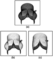 Meshes of the three models: normal (a), remodeling with shaped graft (b), reimplantation with straight conduit (c).