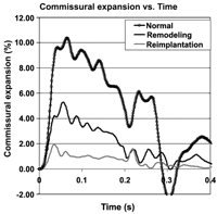 Commissural expansion over the cardiac cycle.