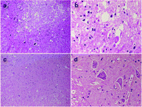 HE staining. The anterior horn of spinal cord at the L5 level in rabbits classified as grade 0 in the group C showed massive ischemic change of neurons (a, b) whereas the anterior horn of spinal cord classified as grade IV in Group E showed well preserved neurons (c, d). Magnifications: a and c, ×100; b and d, ×400; HE, Hematoxylin and Eosin staining.