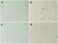 TUNEL staining. The anterior horn of spinal cord at the L5 level in rabbits classified as grade 0 in the group C showed apoptosis presented as brown nuclei (a, b) whereas the anterior horn of spinal cord classified as grade IV in the group E showed no apoptosis (c, d). Magnifications: a and c, ×100; b and d, ×400; TUNEL, terminal deoxynucleotidyl transferase-mediated dUTP-biotin nick end labeling.