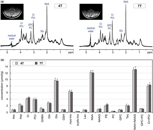 (a) Superposition of in vivo1H-MR spectra acquired from the grey-matter-rich occipital cortex of 10 healthy subjects at 4 T and 7 T (STEAM, VOI = 8 ml, NT = 160, TE = 4 ms at 4 T and TE = 6 ms at 7 T). (b) Comparison of neurochemical profiles determined from these 4T and 7T spectra. Error bars indicate SD. Only concentrations of Asp, GABA, NAAG and PE were statistically different between 4 T and 7 T. Modified with permission from Tkac et al.26 © 2009 John Wiley and Sons.