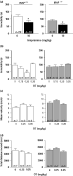 Young male insulin-regulated aminopeptidase wild type (IRAP+/+; left panel) and knockout (IRAP−/−; right panel) mice were treated with (a) 10 mg/kg imipramine (* p < 0.05, Mann–Whitney test, statistically different from saline control) and (b) oxytocin (OT; 0.15, 0.25 and 0.35 mg/kg) before subjecting them to the forced swim test. OT (0.25 and 0.35 mg/kg) was also tested in the open field (c, d). * p < 0.05, Kruskal–Wallis test with Dunn's post hoc test, statistically significant difference from saline control.