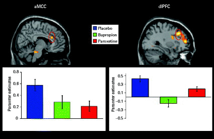 Significant differential functional magnetic resonance imaging activations (analysis of variance for demonstration purposes: p < 0.005, uncorrected) during the anticipation of erotic vs. non-erotic pictures in the anterior midcingulate cortex (aMCC), the right-sided dorsolateral prefrontal cortex (dlPFC, BA9) and medio-frontal gyrus (BA9/10). Plots show parameter estimates of modelled effects averaged over the voxels of the cluster (aMCC, dlPFC) at a statistical threshold of p < 0.05, false discovery rate-corrected.
