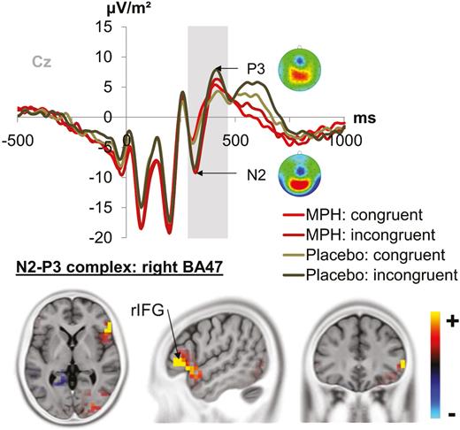 Fronto-central N2-P3 complex. The graph separately depicts the N2-P3 complex (marked by a grey bar) at electrode Cz. Each combination of drug/placebo and flanker congruency (green denotes the placebo condition and red the methylphenidate (MPH) condition, while lighter shades of the respective color denote congruent flankers and darker shades denote incongruent flankers) are depicted. Topography maps of the peaks are depicted next to the respective peak names. Red colors denote positive values, blue colors negative values. The sLORETA plots (corrected for multiple comparisons using statistical nonparametric mapping) show the source of the differential modulations induced by MPH vs placebo depending on flanker congruency. The source was in the right inferior frontal gyrus (rIFG; BA47). The standardized low resolution brain electromagnetic tomography (sLORETA) color scale denotes critical t values.