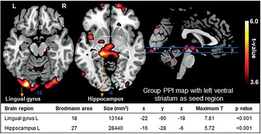 Group psychophysiological interaction (PPI) map for anticipation vs control with left ventral striatum as seed region (n=19; P<.001 uncorrected). Activation in left ventral striatum was significantly correlated with that in left lingual gyrus and left hippocampus (P<.001, FWE-corrected at cluster level). X, y, and z are Montreal Neurological Institute coordinates and represent the highest t value in a cluster. Numbers below slices indicate Montreal Neurological Institute z coordinates. L, left; R, right.