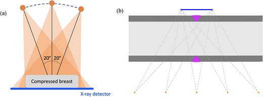 (a) Imaging geometry of DBT, based on collecting several radiographs of the compressed breast at various angles. Typically, the most extreme directions are $\pm 20^{\circ }$ from the vertical, as shown in the image. While only three projections are depicted here, real DBT systems collect more (e.g. 15) images within the $40^{\circ }$ angular range available. Limited-angle imaging geometry is forced by the compression of the breast against the detector plate. If the angle becomes too extreme, the rays passing through the tissue will not hit the detector. (b) Imaging geometry for X-ray inspection of weldings in pipelines used for example in process industry. Shown is a longitudinal cross-section of the pipe, with dark gray colour indicating metal. The purple area is the weld connecting two pieces of pipe together. Limited-angle imaging geometry is necessary as both the X-ray source and the detector need to be outside the long pipeline.