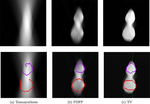 Comparisons of reconstructions with the corresponding learned boundary estimates for a modified $xz$-slice, where the inclusions are vertically close to each other. Reconstructions are computed using (a) tomosynthesis, (b) PDFP with complex wavelet regularization (1000 iterations) and (c) TV regularization ($\alpha =5\times 10^{-5}$, 10 000 iterations). On the bottom row, the learned boundary estimate is added to each corresponding reconstruction as an overlay. Imaging geometry: parallel beam, 40-degree opening angle (70–110), 50 projections, Poisson noise. The dotted line indicates the column plotted in Fig. 18.