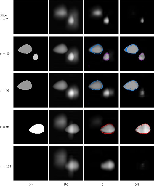 Different $xy$-slices through the three-dimensional test phantom of Fig. 16(a) and through 3D-volumes achieved by stacking 2D-reconstructions from $xz$-planes. In the model, $xy$-slices are parallel to the detector surface. (a) Ground truth slice. (b) Tomosynthesis. (c) PDFP reconstruction using complex wavelet regularization with learned boundary estimate. (d) TV-regularized reconstruction (5000 iterations) with learned boundary estimate. Note that one can deduce from the boundary curves that the grey features in the top and bottom images of column (c) are artefacts.