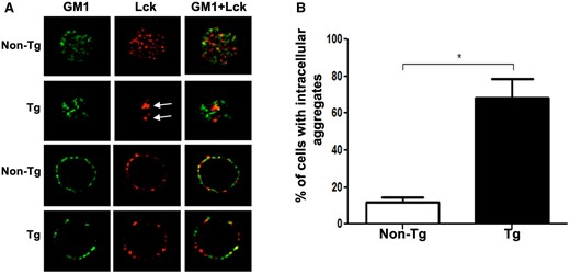 Nef interferes with proper Lck localization in thymocytes of Nef Tg mice. Immunofluorescence (IF)/confocal microscopy analysis of isolated thymocytes of Nef Tg and non-Tg mice. (A) Cells were labeled with anti-Lck (3A5) (red) Ab and the microdomain membrane marker, cholera toxin subunit B, GM1 (green). Images showed staining in electronic slices located near the pole (upper panels) and equator (lower panels) of the cell. Arrows show intracellular Lck accumulation. (B) Quantification of percentage of cells showing intracellular Lck accumulation in (A). At least 20 cells counted in each of 3 independent experiments. Statistical comparison was performed using the Student’s t test. *P <0.05.
