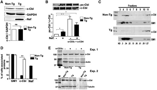 Alteration of c-Cbl phosphorylation and localization in Nef Tg thymocytes. (A) Levels of total c-Cbl and Nef proteins from Nef Tg and non-Tg thymocyte extracts were measured by Western blot with respectively anti-c-Cbl (7G10) or anti-Nef Ab. Protein loading was determined with anti-GAPDH Ab. For quantification (graph), the intensity of the c-Cbl band was evaluated relative to that of the GAPDH band (ratio c-Cbl/GAPDH) and compared to that in non-Tg extract (value = 1). Data pooled from 3 independent experiments. Statistical comparison was performed using the Student’s t test. ns, nonsignificant. (B) Total thymocytes of Nef Tg and non-Tg mice were stimulated or not with anti-CD3ε+anti-CD4 Abs for 5 min at 37 °C. Cell extracts were immunoprecipitated with anti-c-Cbl Ab (7G10), and phosphorylated c-Cbl (pc-Cbl) was measured by Western blot with anti-pY 4G10 Ab (upper panel). Protein loading was determined by evaluating the levels of precipitated c-Cbl with anti-c-Cbl Ab (lower panel). For quantification (graph), the intensity of pc-Cbl was evaluated relative to that of c-Cbl (ratio p-cCbl/c-Cbl) and compared to that in unstimulated non-Tg thymocytes (value = 1). Data pooled from 3 independent experiments. Statistical comparisons were performed using the Student’s t test. *P < 0.05; **P < 0.01. (C–E) Reduction of c-Cbl associated with lipid rafts in Nef Tg thymocytes. Plasma membranes from Tg and non-Tg thymocytes were prepared and fractionated by sucrose density gradient centrifugation, as described in Materials and methods. (C) Fractions were collected and either subjected to SDS-PAGE and Western blotting with anti-c-Cbl Ab or spotted onto nitrocellulose and probed for GM1. One experiment is shown. (D) Quantification of c-Cbl proteins (graph) in low-density gradient fractions 3 to 6, corresponding to lipid rafts, was determined relative to total proteins loaded onto the gradient. (E) Blotting of total thymocytes lysates with anti-c-Cbl (upper panels) and after stripping with anti-actin or anti-tubulin (lower panels) Abs. Note that equivalent levels of c-Cbl were found in Nef Tg (+) and non-Tg (–) thymocytes. Two independent experiments are shown. M, markers.