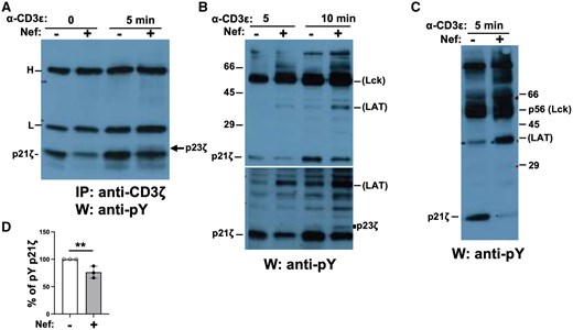 Decreased tyrosine phosphorylation of CD3ζ in Nef Tg thymocytes. Thymocytes of Nef Tg (+) and non-Tg (–) mice were stimulated or not with anti-CD3ε Ab. (A) Cell extracts were immunoprecipitated with anti-CD3ζ Ab, and phosphorylated CD3ζ detected in Western blot with anti-pY 4G10 Ab. H, L, heavy and light chains of immunoglobulin, respectively. (B, C) Total protein extracts of thymocytes were run on SDS-PAGE and transferred to membranes for Western blotting with anti-pY 4G10 Ab for detection of total phosphoproteins. Two independent experiments are shown. Note the increase of Tg p23 CD3ζ and p37 (likely LAT) and decrease of p21 CD3ζ phosphorylation after stimulation. This latter decrease was observed in 8 independent experiments. In (B), membrane was exposed for a short (upper panel) and longer (lower panel) time. (D) Quantification of phosphorylated (pY) p21 CD3ζ proteins (graph). Percentage of pY p21 CD3ζ levels in Tg cells relative to those in non-Tg cells (value = 100%) in 3 independent experiments. Student’s t test, **P < 0.01.