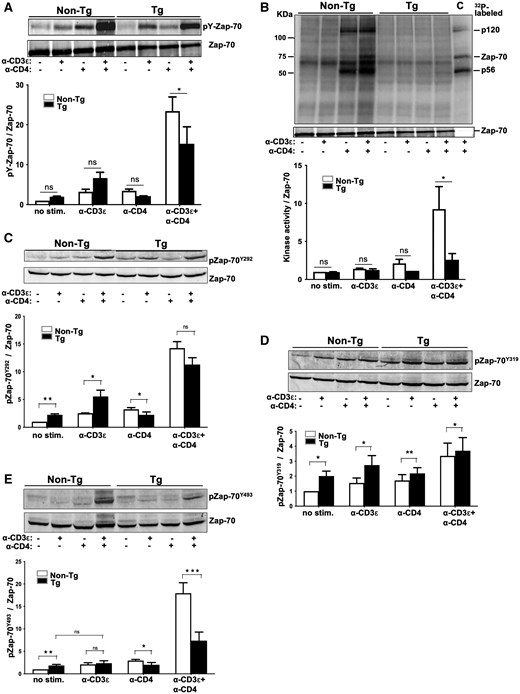 Altered tyrosine phosphorylation of Zap-70 in Nef Tg thymocytes. Total thymocytes of Nef Tg and non-Tg mice were subjected (+) or not (–) to stimulation with anti-CD3ε or anti-CD4 or both anti-CD3ε+anti-CD4 Abs for 5 min at 37 °C. (A) Cell extracts were immunoprecipitated with rabbit polyclonal anti-Zap-70 Ab and phosphorylated Zap-70 (pY-Zap-70) analyzed in Western blot with anti-pY 4G10 Ab (upper panel). For protein loading, membrane was stripped and reacted with anti-Zap-70 (99F2) Ab (lower panel). For quantification (graph), the intensities of pY-Zap-70 were evaluated relative to those of Zap-70 and compared to those in unstimulated non-Tg cells (value = 1). Data pooled from 3 independent experiments. Note that the pY-Zap-70 band shown (upper panel) is the same as the one shown in Fig. 6 and cropped from it. The Zap-70 band (lower panel) is also the same as the one shown in Fig. 6 and Fig. 5B, because the experiment was done on the same extracts. (B) Zap-70 kinase activity was measured, as described above in the legend of Fig. 2F, on rabbit polyclonal anti-Zap-70 Ab immunoprecipitates (same extracts as in Fig. 6), using an IVKA. 32P-labeled proteins, separated on SDS-PAGE, are shown in upper panel. Western blotting with anti-Zap-70 Ab (lower panel). Quantification (graph) was performed as described above in Fig. 5A. Data pooled from 3 independent experiments. C, control representing IVKA on anti-Lck immunoprecipitates of non-Tg thymocyte extracts. Note that the lower panel (Zap-70) is the same as the one in Fig. 5A and Fig. 6, because the experiment was done on the same extracts. (C–E) Zap-70 phosphorylation at Y292, Y319, and Y493 pY sites. Levels of phosphorylated pZap-70Y292 (C), pZap-70Y319 (D), and pZap-70Y493 (E) were determined with phospho-specific, site-specific anti-ZAP-70Y292, ZAP-70Y319, ZAP-70Y493 Abs, respectively (upper panels). Membranes were stripped and reacted with anti-Zap-70 (99F2) Ab (lower panels). Representative images from one out of three independent experiments. Quantification (graphs) was performed as described above in Fig. 5A, by pooling data from three independent experiments. Statistical comparisons were performed using the Student’s t test. *P < 0.05; **P < 0.01; ***P < 0.001; ns, not significant.