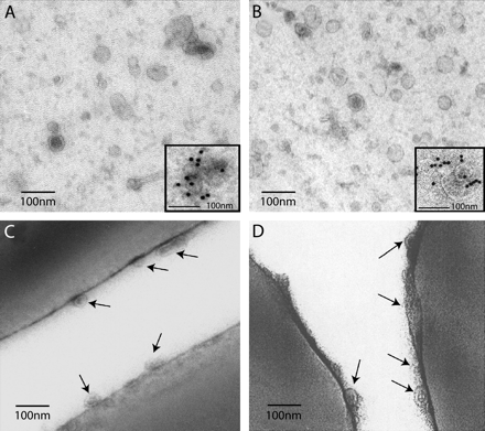 Morphological characterization of 110 000 × g pellets by EM. (A and B), whole mounted microvesicles. (C and D) ultrathin cryosections of latex beads used for immunoisolation. This figure is representative of three different experiments (A) Microvesicles isolated from blood plasma, (B) exosomes isolated from HMC-1 cell line. Insert: indirect immunogold labeling with anti-CD63 mAb (MoF11) followed by protein A coupled to 10-nm gold particles. Blood plasma microvesicles were specifically labeled. In (C) and (D) details of the surface of the ultrathin cryosectioned latex beads (C) CD63 immunoisolated membranes from the 110 000 g plasma pellet (D) CD63 immunoisolated membranes from the supernatant of HMC-1 cells. Note in both cases the small membrane vesicles at the surface of the beads (indicated by arrows). Bars, 100 nm.