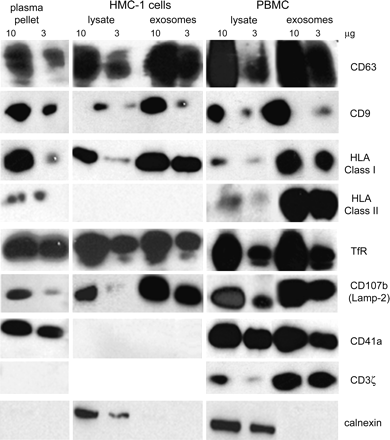 Biochemical characterization of microvesicles by western blot. PBMC or HMC-1 cell lysates or their exosomal preparations from a 2-day culture supernatant were compared with 110 000 × g pellet from blood plasma. For western blot analysis, all samples were lysed in lysis buffer (1% Nonidet P-40, 0.5% 2 μg ml−1 leupeptin, 1% aprotinin, and 1 mM phenylmethylsulfonylfluoride) for 20 min at 4°C. Solubilized microvesicles or post-nuclear lysates were quantified by Bradford assay, solubilized in Laemmli loading buffer and analyzed under reducing or non-reducing (for tetraspanin) conditions. Ten or three micrograms of protein were separated on 12% SDSP, transferred to polyvinylidene difluoride membrane (Millipore), incubated with specific antibodies (CD63, CD9, MHC class I, MHC class II, CD107b, TfR, CD41a, CD3ζ and calnexin), followed by HRP-conjugated secondary antibodies and detected using an enhanced chemiluminescence kit (Roche Diagnostics).