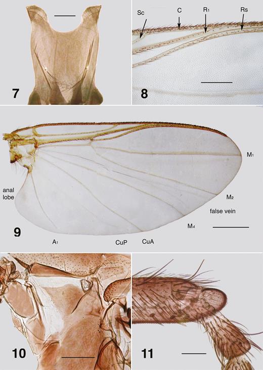 Ectemnoides umbratorum female. (7) Cibarium (Acheron). Scale bar = 0.05 mm. (8) Wing veins (Acheron). Sc – subcosta; C – costa; R1 – radius; Rs – radial sector. Scale bar = 0.1 mm. (9) Wing (Acheron). A1 – anal; CuA, CuP – cubital; M1, M2, M4 – medial. Scale bar = 0.5 mm. (10) Anepisternal membrane, cleared (Grampians). Scale bar = 0.2 mm. (11) Hind basitarsus and tarsomere II (Narbethong). Scale bar = 0.05 mm.