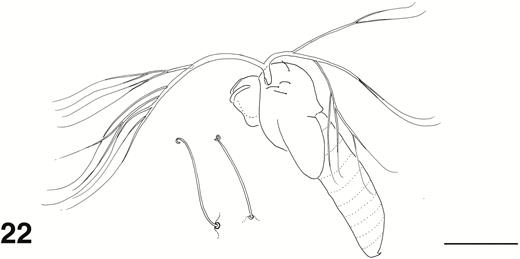 Ectemnoides umbratorum pupal habitus. Insert: dorsocentral thoracic hairs. Original as for Fig. 21. Scale bar = 1.0 mm.