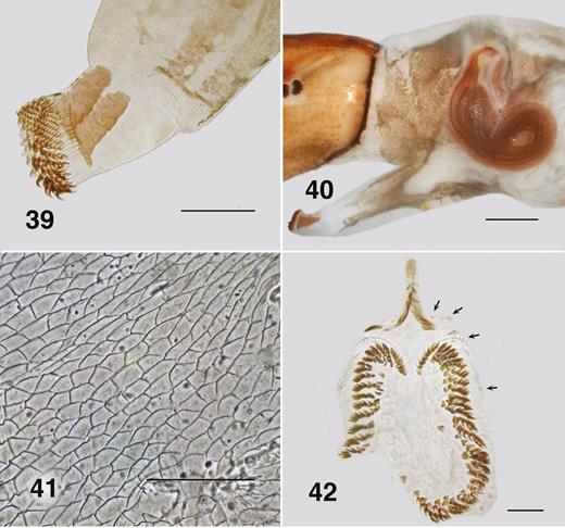 Ectemnoides umbratorum larva (Grampians). (39) Anterior thoracic proleg. Scale bar = 0.1 mm. (40) Lateral view of pupal gill histoblast. Scale bar = 0.2 mm. (41) Abdominal cuticle. Phase contrast. Scale bar = 0.05 mm. (42) Posterior proleg, circlet of hooks, anal sclerite. Arrows indicate campaniform sensilla. Scale bar = 0.05 mm.