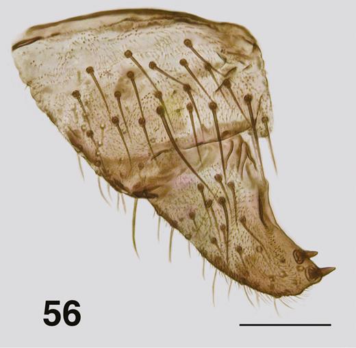 Ectemnoides faecofilus male adult gonocoxa and stylus. Paratype. Scale bar = 0.05 mm.