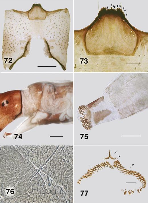 Ectemnoides faecofilus larva. (72) Postgenal cleft (Carey Brook). Scale bar = 0.2 mm. (73) Hypostoma (Carey Brook). Scale bar = 0.05 mm. (74) Pharate pupal gill (Carey Brook). Scale bar = 0.2 mm. (75) Prothoracic proleg (Carey Brook). Scale bar = 0.1 mm. (76) Abdominal cuticle. Paratype. Phase contrast. Scale bar = 0.05 mm. (77) Anal sclerite and circlet of hooks. (Rosa Brook). Arrows indicate campaniform sensilla. Scale bar = 0.05 mm.