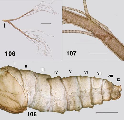 Ectemnoides acanthocranius pupa. (106) Pupal gill. Arrow indicates position of broken diverticulum (cf. Fig. 120). Scale bar = 0.5 mm. (107) Gill surface. Scale bar = 0.1 mm. (108) Pupal abdomen showing armature. Scale bar = 0.5 mm.