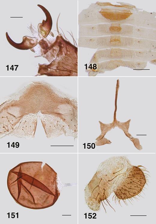 Ectemnoides princeae female. (147) Tarsal claws. Note basal tooth variation. Scale bar = 0.02 mm. (148) Abdominal tergites. Scale bar = 0.5 mm. (149) Hypogynial valves. Scale bar = 0.1 mm. (150) Genital fork. Scale bar = 0.05 mm. (151) Spermatheca. Scale bar = 0.02 mm. (152) Cercus and anal lobe. Scale bar = 0.05 mm.