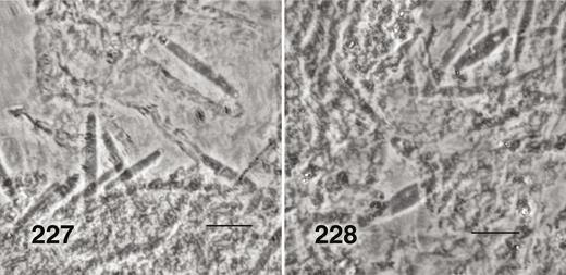 Ectemnoides sp. A, larval hindgut trichomycetes. (227) Furculomyces westraliensis. Phase contrast. Scale bar = 0.01 mm. (228) Zancudomyces culisetae. Phase contrast. Scale bar = 0.01 mm.