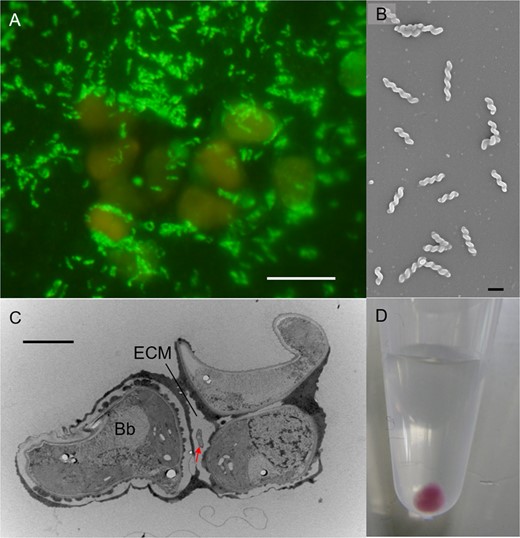 A CARD-FISH image of the two-membered culture of B. braunii (orange) and BOTRYCO-1 (yellow-green). Scale bar, 10 μm. B SEM photo of BOTRYCO-1 showing a spiral shape. Scale bar, 1 μm. C TEM photo showing a BOTRYCO-1 cell inside the extracellular matrix (ECM) of B. braunii. Arrow indicates BOTRYCO-1. Bb, B. braunii. Scale bar, 2 μm. D Collected cells of BOTRYCO-1 in a 1.5 mL microtube.