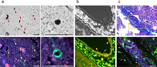 a Colonization of B. adolescentis on starch granules (arrowheads). Upper: iodine staining; Lower: FISH (Green: B. adolescentis, red: B. catenulatum group, blue: genus Bifidobacterium); B. adolescentis appears cyan because its green signal is merged with the blue signal from genus Bifidobacterium. Images on the right are high-power images of those on the left. b Colonization of Lachnospiraceae on plant tissue (arrowheads). Upper: phase contrast. Lower: FISH (Green: Lachnospiraceae, red: total bacteria). Lachnospiraceae appears yellow because its green signal is merged with the red signal from total bacteria. c Localization of Bifidobacterium and Lachnospiraceae near mucus layer (between arrowheads). Upper: Alcian blue PAS staining. Lower: Fluorescent image of a serial section corresponding to the rectangle in upper image (Green: genus Bifidobacterium, red: Lachnospiraceae, blue: total bacteria). Bars = 50 μm. *, Autofluorescence from plant-like structures.