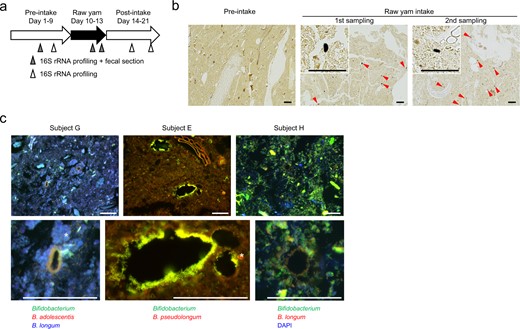 a Design of the raw yam intake experiment (ten subjects). b Starch granules were specifically detected during the raw yam intake period. Typical images of iodine-stained fecal sections are shown (specimens from subject B). Bars = 100 μm. Arrowheads: starch granules. c Colonization of bifidobacterial species on starch granules during the raw yam intake period. Bars = 50 μm. *, Autofluorescence.