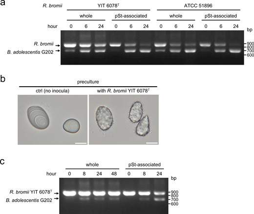 aR. bromii YIT 6078 T or R. bromii ATCC 51896 and B. adolescentis G202 were simultaneously inoculated into pSt-GAM broth and incubated for the indicated time. Relative abundance of two strains was determined by competitive PCR. b, cR. bromii YIT 6078T was grown on pSt-GAM broth for one day and subsequently B. adolescentis G202 was inoculated and the cultures were incubated for the indicated time. b Bright-field images of pSt without bacteria and R. bromii-associated pSt just before inoculation of G202. Bars = 20 μm. c Relative abundance of the two strains was determined as in a. pSt was completely degraded and no pSt-associated fraction was obtained at 48 h.