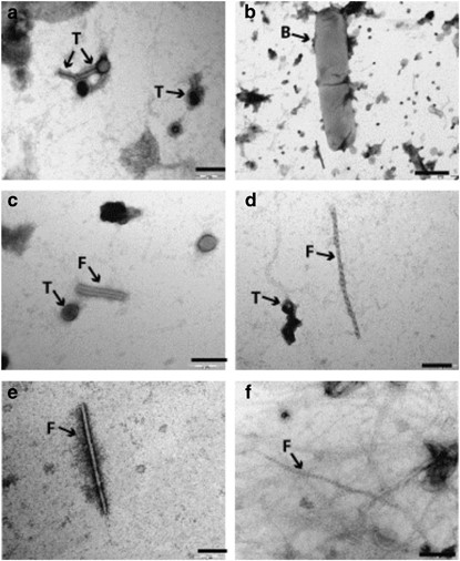 Transmission electron micrographs of viruses and bacteria from 9°N East Pacific Rise: (a and b) 2500 m water sample; (c and d) Bio9 vent; and (e and f) M and Q vents. Filamentous phage (F); tailed phage (T) and bacterium (B). Scale bars: (a, c and d) 100 nm; (e) 200 nm; (b) 500 nm.