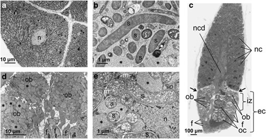 Transmission electron microscopy of the endosymbiotic system of Nysius plebeius. (a) Bacteriocytes in a bacteriome whose cytoplasm is filled with tubular endosymbiont cells. (b) An enlarged image of the endosymbiont cells in the bacteriome. (c) A light microscopic image of semi-ultrathin section of a germarium region of an ovariole, stained with toluidine blue. (d) An enlarged image of infection zone in an ovariole, where ovarial bacteriocytes containing many endosymbionts are surrounded by follicular cells. (e) An enlarged image of endosymbiont cells in an ovarial bacteriocyte. Asterisks indicate vacuole-like structures that are abundantly found in the ovarial bacteriocytes. b, bacteriocyte; ec, egg chamber; f, follicular cell; iz, infection zone; n, nucleus; nc, nurse cell; ncd, nutritive cord; ob, ovarial bacteriocyte; oc, oocyte; s, endosymbiont cell.