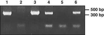 Co-transcription of ntcA (lanes 1–3) and ORF5 (lanes 4–6) in N2-fixing filaments of Trichodesmium IMS101. PCR amplicons were derived from genomic DNA (lanes 1 and 4) and total RNA before (lanes 2 and 5) and after (lanes 3 and 6) reverse transcriptase treatment.