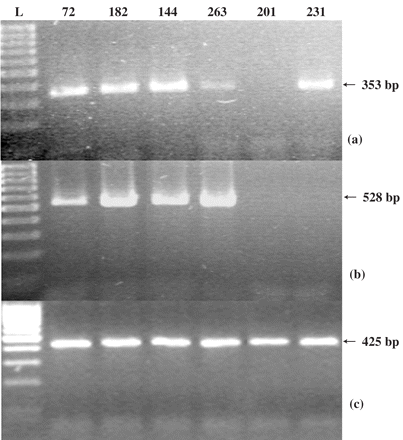 RT–PCR products showing expression of the blaOXA-51 (a), blaOXA-58 (b) and recA (c) genes of A. baumannii isolates representative of each PFGE type that carry both blaOXA-51 and blaOXA-58. Lane L, 100 bp DNA ladder. Sizes of the amplified fragments are indicated by arrows. The index numbers of the isolates are those listed in Table 1.