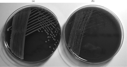 (a) MRSA (F1854) recovered from the triclosan-impregnated silicone at 0 h (i.e. after 1 h adherence period). No SCVs are seen. (b) MRSA (F1854) after extended exposure to triclosan for 72 h. The culture now consists almost entirely of SCV. Again, both F1853 and F1855 gave similar results.