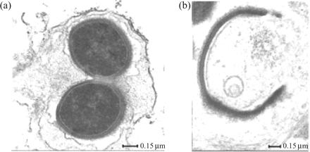 The ex vivo effects of thioridazine on the ultrastructure of Staphylococcus aureus phagocytosed by monocyte-derived macrophages. (a) Control; (b) thioridazine-treated 6 h post-phagocytosis; thioridazine (0.1 mg/L) was added to the medium 30 min after phagocytosis.110