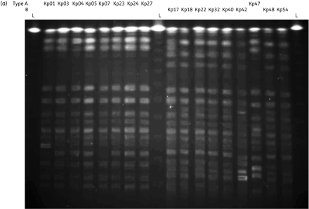 (a) PFGE of XbaI macrorestriction of selected K. pneumoniae isolates, demonstrating PFGE type A (Kp01, Kp03, Kp04, Kp05, Kp07, Kp23, Kp24, Kp27 and Kp47) and type B (Kp17, Kp18, Kp22, Kp32, Kp40, Kp42, Kp48 and Kp54). L corresponds to lambda ladder. (b) Dendrogram describing percentage similarity and band patterns of K. pneumoniae by rep-PCR, interpreted using the Kullback–Leibler method. Similarity within group 1 (1–17) and within group 2 (19–28) is ∼95%. Similarity between the two groups is ∼85%. Also in this figure, the type of blaKPC detected, PFGE types, results of susceptibility testing against amikacin (AMK) and gentamicin (GEN) and location in hospital ward, medical intensive care unit (MICU), surgical intensive care unit (SICU) and long-term acute care hospital (LTACH).