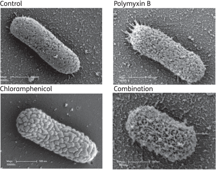 SEM images of K. pneumoniae 1 in the absence of drug therapy (control) or in the presence of polymyxin B at 2 mg/L, chloramphenicol at 32 mg/L or the combination of these. Scale bar = 500 nm.