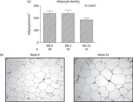 Histological analysis of the adipose tissue biopsies of subjects initiating HIV PI-only ART. (a) Change in adipose tissue adipocyte density over 24 weeks. The number of adipocytes per field (×10 magnification) was quantified using viewing software with adipocyte density expressed as the number of adipocytes/mm2. Data are presented as mean (SEM) and P values correspond to the output of marginal model analyses; n = 18, 18 and 14 at weeks 0, 2 and 24, respectively. Wk, week. (b) Representative micrographs of adipose tissue biopsy sections at week 0 and at week 24 taken at ×10 magnification, stained with haematoxylin phloxine saffron.